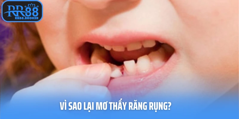 Vì sao lại mơ thấy răng rụng?
